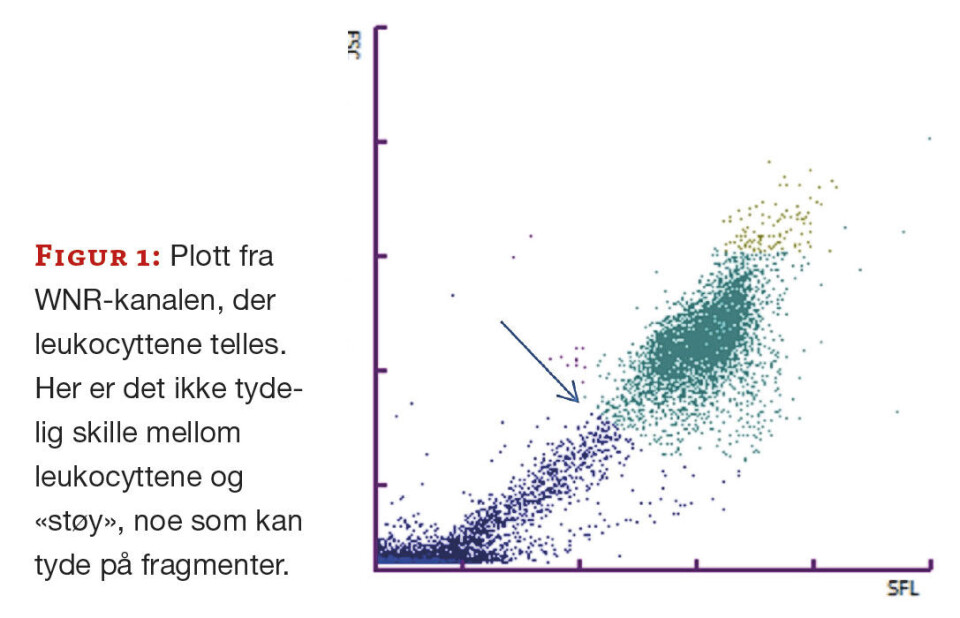 Blodsykdom eller preanalyse?
