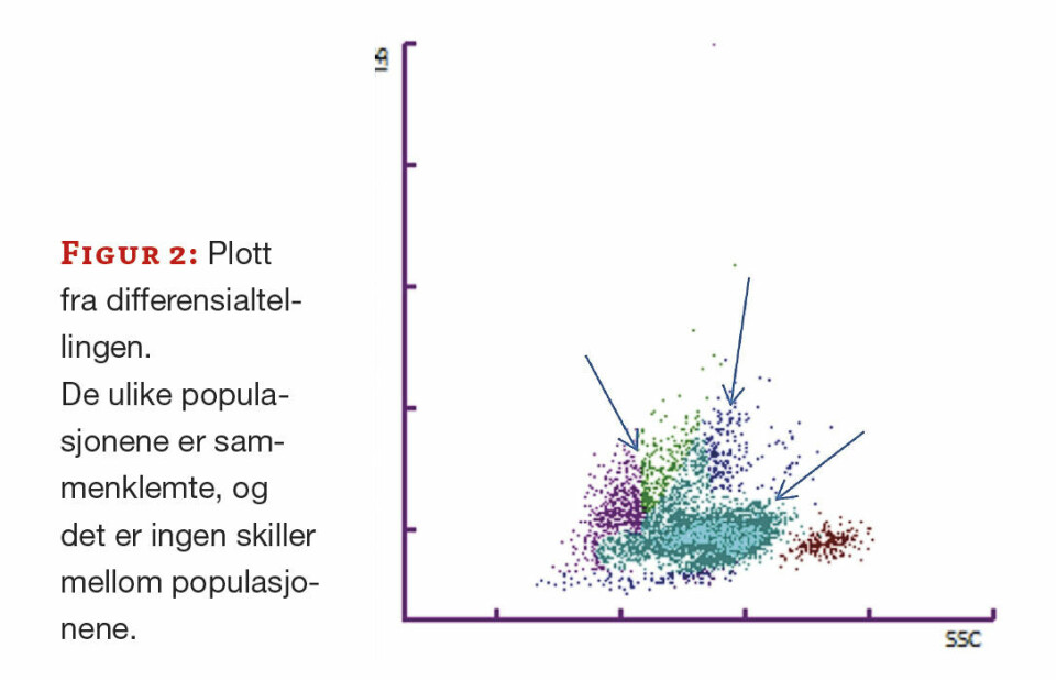 Blodsykdom eller preanalyse?