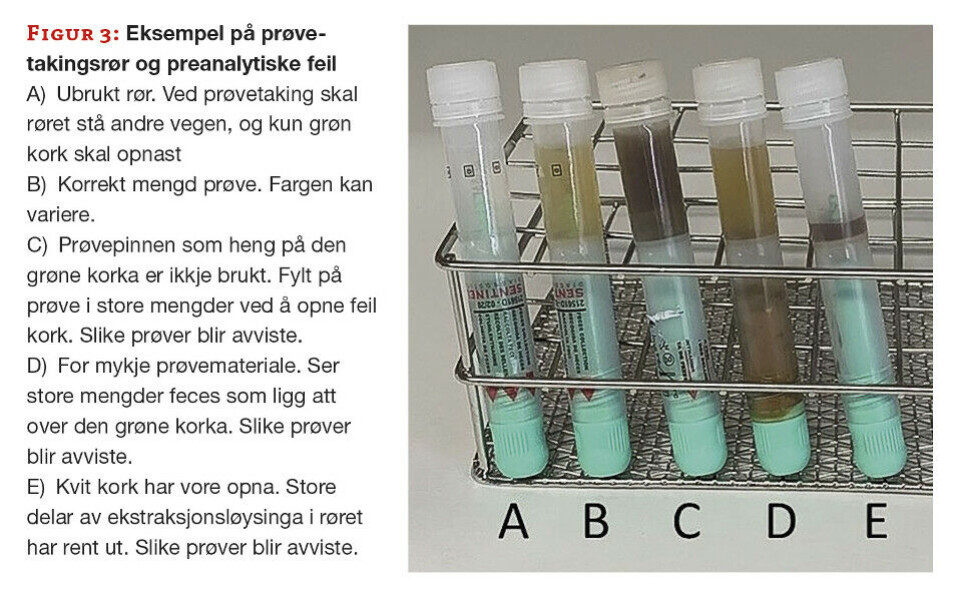 Implementering av automatisert, kvantitativ måling av blod i feces med immunologisk metode