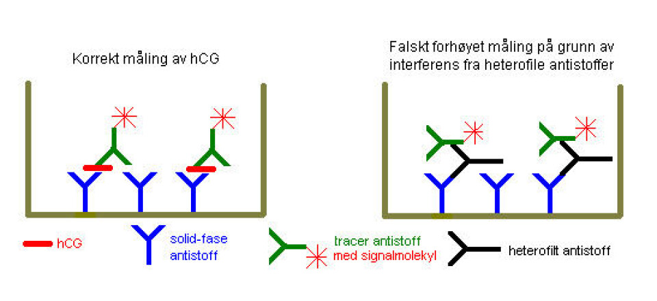Figur 1. En svært forenklet skisse som illustrerer hvordan heterofile antistoffer kan kryssbinde solid-fase og tracer antistoffene og gi et falskt forhøyet resultat.