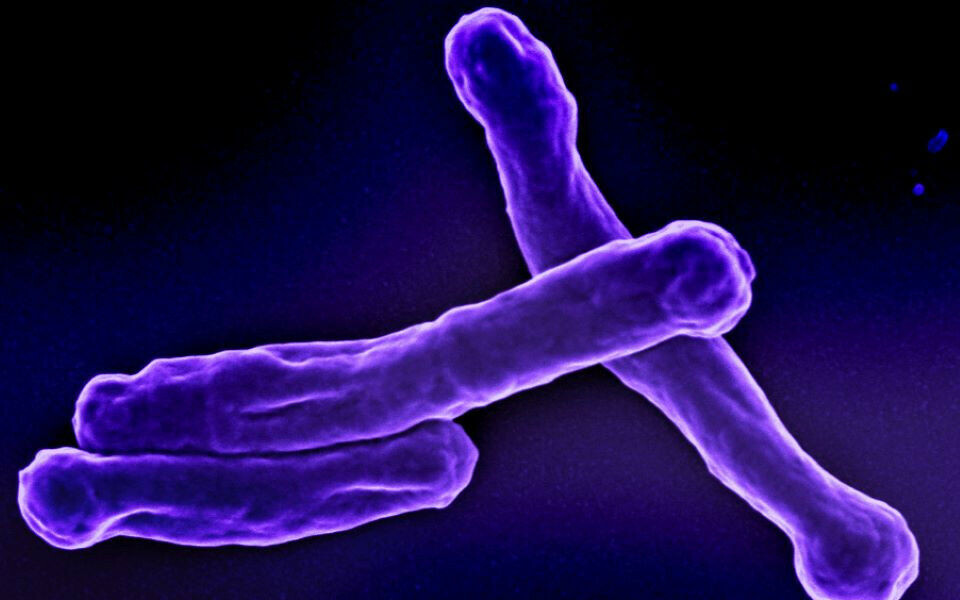 Mycobacterium tuberculosis. Foto: NIAID
