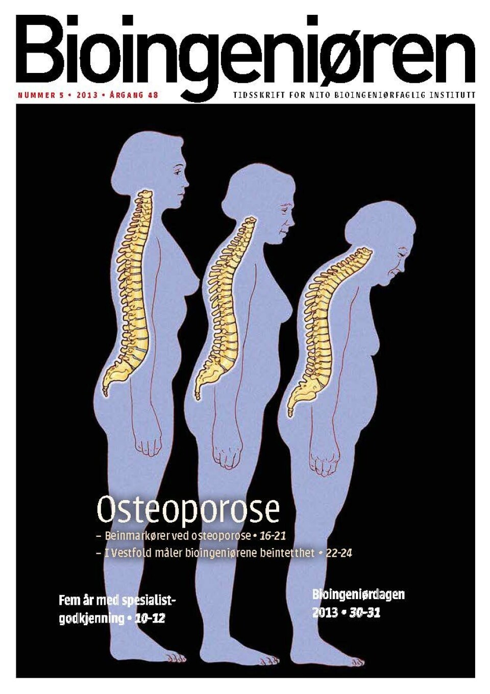 5/13: Osteoporose