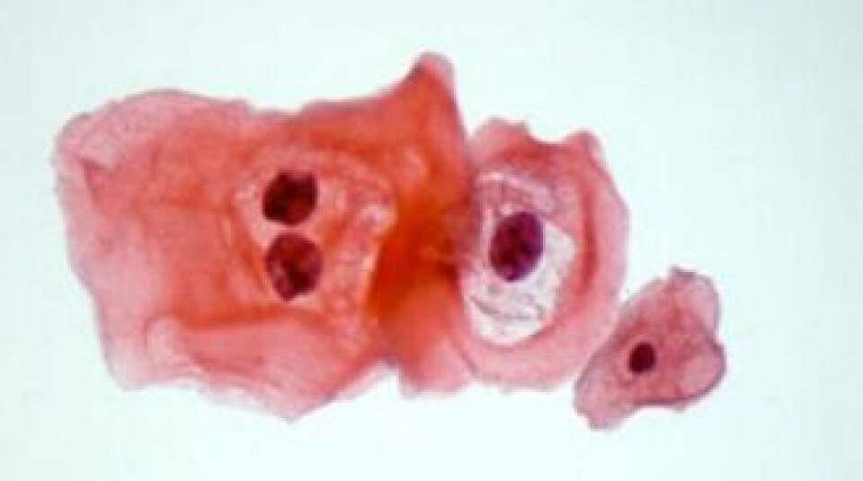 Cervixcytologi for 'dummies'
