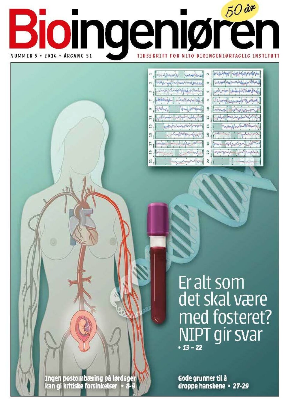 5/16: Ikke-invasiv prenatal test (NIPT) Bioingeniøren 5, 2016