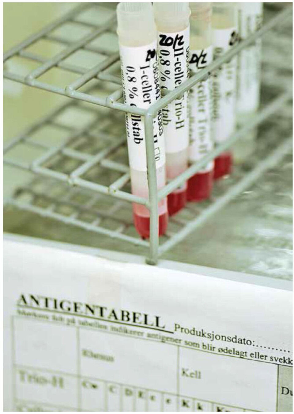Blodtypeantigener oppstår på grunn av genetiske polymorfismer, og arves fra begge foreldre. Før en transfusjon blir pasientens plasma testet mot celler med alle de klinisk viktigste blodtypeantigenene. Illustrasjonsfoto: Svein Arild Sletteng