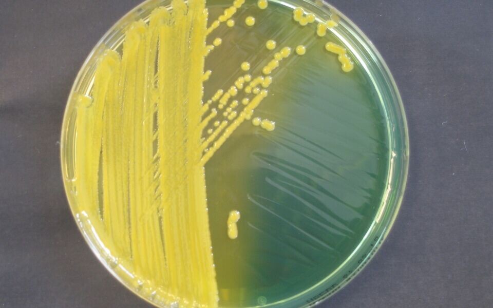 Klebsiella-stamme med resistensegenskapen NDM-1. Prøven kom fra en norsk kvinne som hadde vært innlagt på sykehus i India. Arkivfoto: Nasjonal kompetansetjeneste for påvisning av antibiotikaresistens.