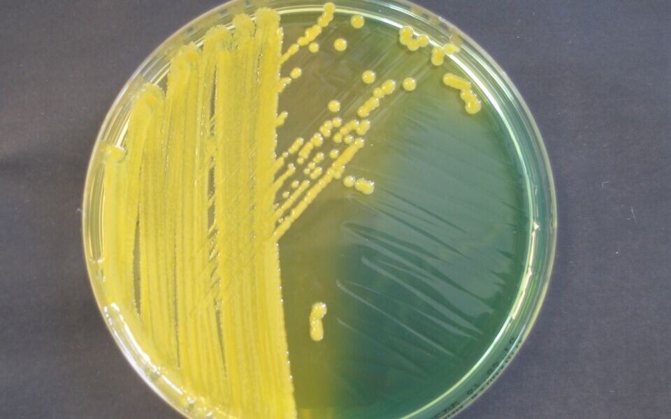 Den NDM-1 positive Klebsiella-stammen som ble isolert fra Lill-Karin Skaret etter at hun hadde vært innlagt på sykehus i India. Foto: K-res.