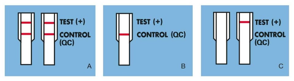 Figur 3: Tolkning av analyseresultater for InSure® FIT™ (7). A) Positiv B) Negativ C) Inkonklusiv. Illustrasjonen er modifisert og gjengitt med tillatelse fra Clinical Genomics. Figur 3: Tolkning av analyseresultater for InSure® FIT™ (7). A) Positiv B) Negativ C) Inkonklusiv. Illustrasjonen er modifisert og gjengitt med tillatelse fra Clinical Genomics.