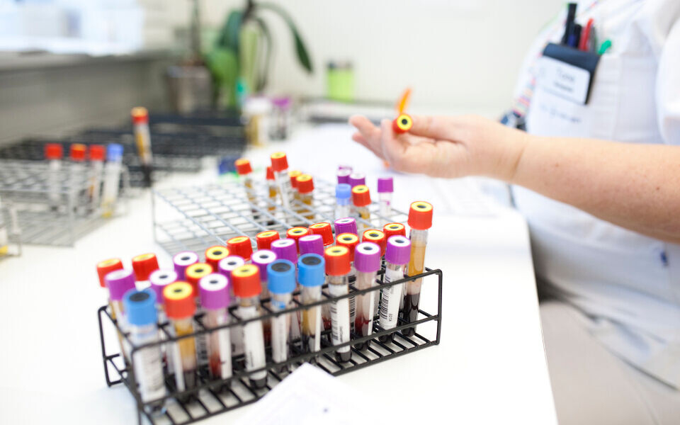 Overrekvirering er et problem mange laboratorier vil kjenne til. Slett ikke alle prøver som tas og analyseres er medisinsk nødvendige. Illustrasjonsfoto: Annette Larsen