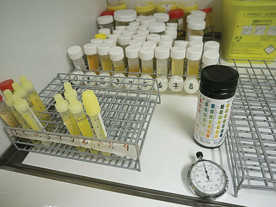 Siden Rikshospitalet gjør alle nyretransplantasjoner i Norge, har sykehuset ekstra mange urinprøver. Urinautomasjonen kommer til å lette arbeidet betraktelig. Foto: Grete Hansen.