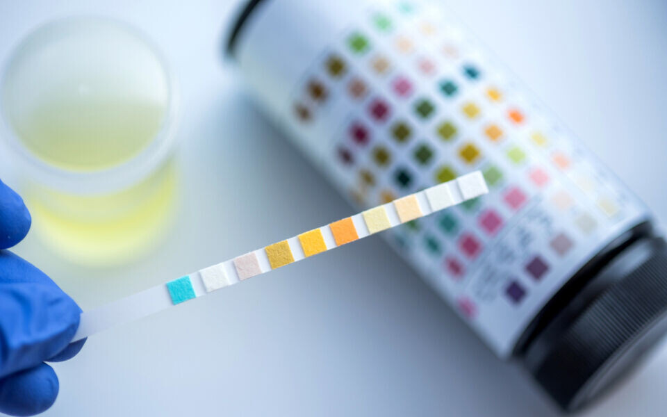 Arbeidet med å forbedre hjemmetjenestenes laboratorievirksomhet har mistet statsstøtten. Illustrasjonsfoto: iStock