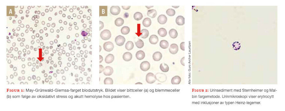 En kasuistikk som illustrerer nytteverdien av bioingeniører som diagnostiske samarbeidspartnere