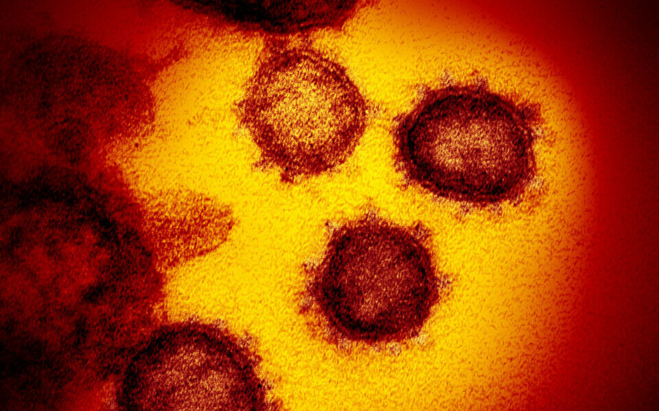 SARS-CoV-2. Foto: The National Institute of Allergy and Infectious Diseases’ Rocky Mountain Laboratories (NIAID-RML).