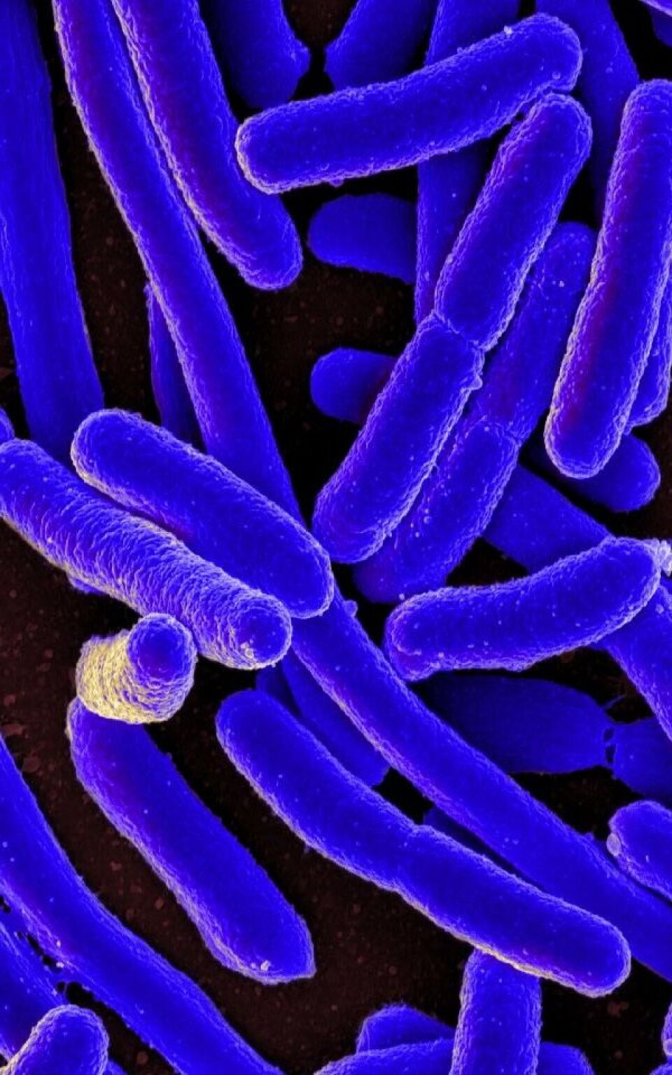 Foto: National Institute of Allergy and Infectious Diseases, National Institutes of Health, CC BY-NC 2.0 DEED