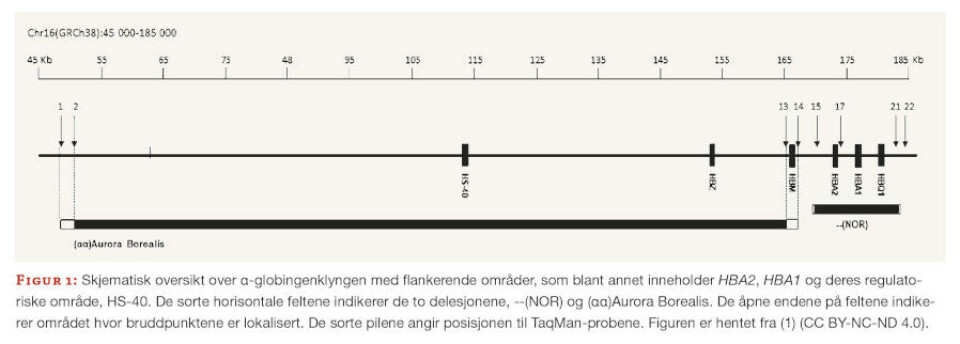 Hemoglobinopati på avveie – α-talassemi hos pasienter av norsk opprinnelse