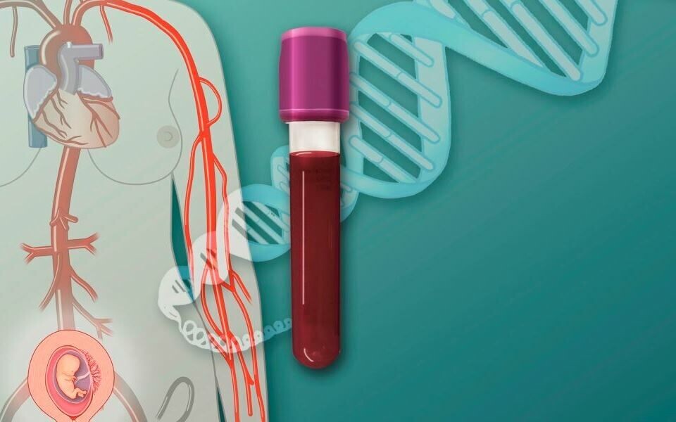 Ikke-invasiv prenatal test (NIPT) går ut på at man analyserer en blodprøve fra den gravide. I morens blod finner man også cellefritt DNA fra fosteret.