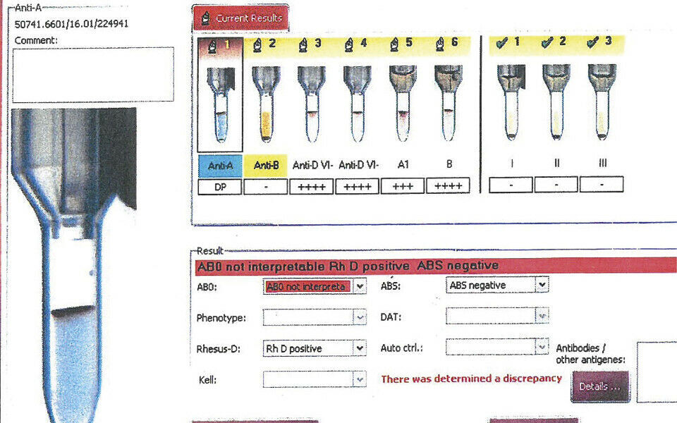 Et uventet blodtyperesultat