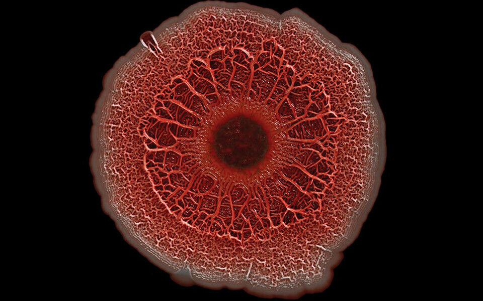 Pseudomonas aeruginosa i biofilm. Foto: NIH Image Gallery / Scott Chimileski og Roberto Kolter, Harvard Medical School, Boston
