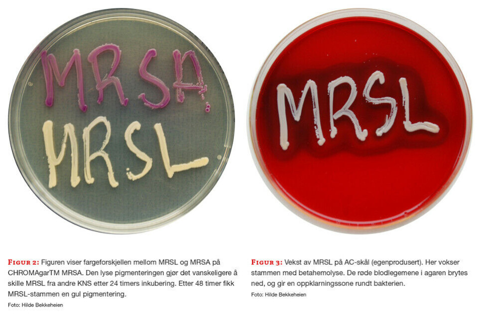 Utbrudd av Staphylococcus lugdunensis med uvanlig resistensmønster