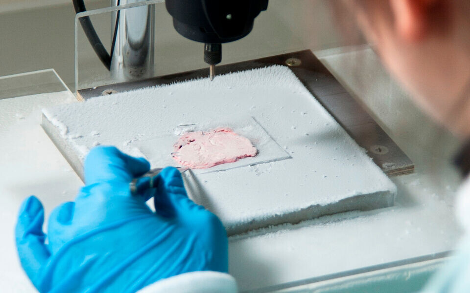 Ferskfrosset vevsskive fra prostata plassert på en aluminiumsblokk, kontinuerlig avkjølt med flytende nitrogen. Ved hjelp av en drill borres det ut vevssylindere som brukes til bestemmelse av RIN og måling av 8-isoprostan