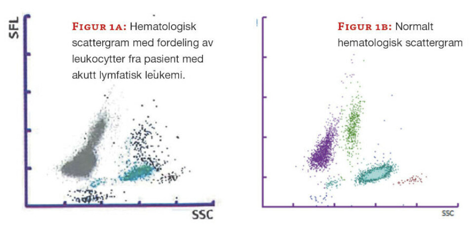 Slik påvises akutt leukemi med hematologiske metoder