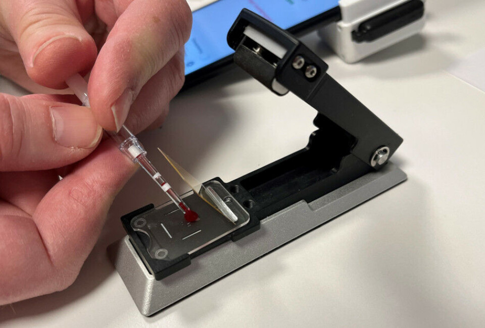 Blodet påføres et testkort med nanosøyler som gjør det mulig å 'printe' flere analyser på samme kort.