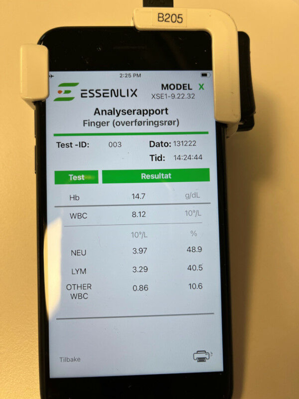 Foreløpig måler iMOST bare Hb og hvite blodlegemer, men flere analyser er på gang.