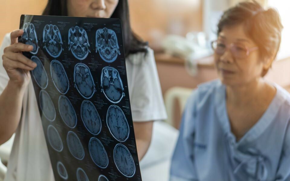 Alzheimer-diagnostikk i dag innebærer billedtaking av hjernen og måling av biomarkører i spinalvæskeprøve. Illustrasjonsfoto: Chinnapong/iStockphoto