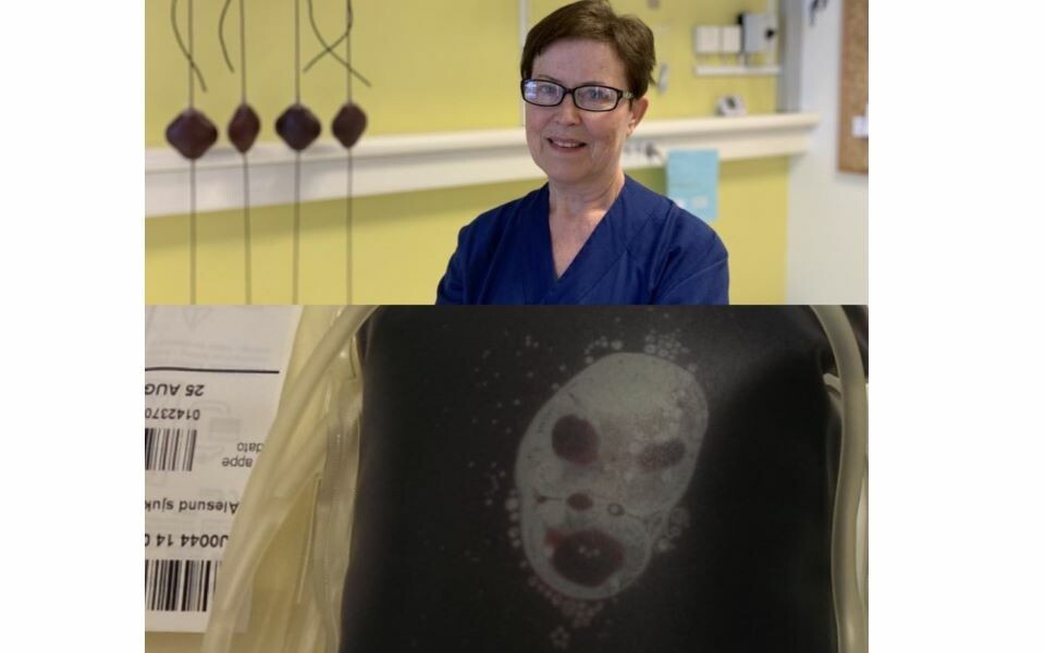 Marianne Sjøli kom over denne mildt sagt skremmende blodposen på jobb. Foto: Privat