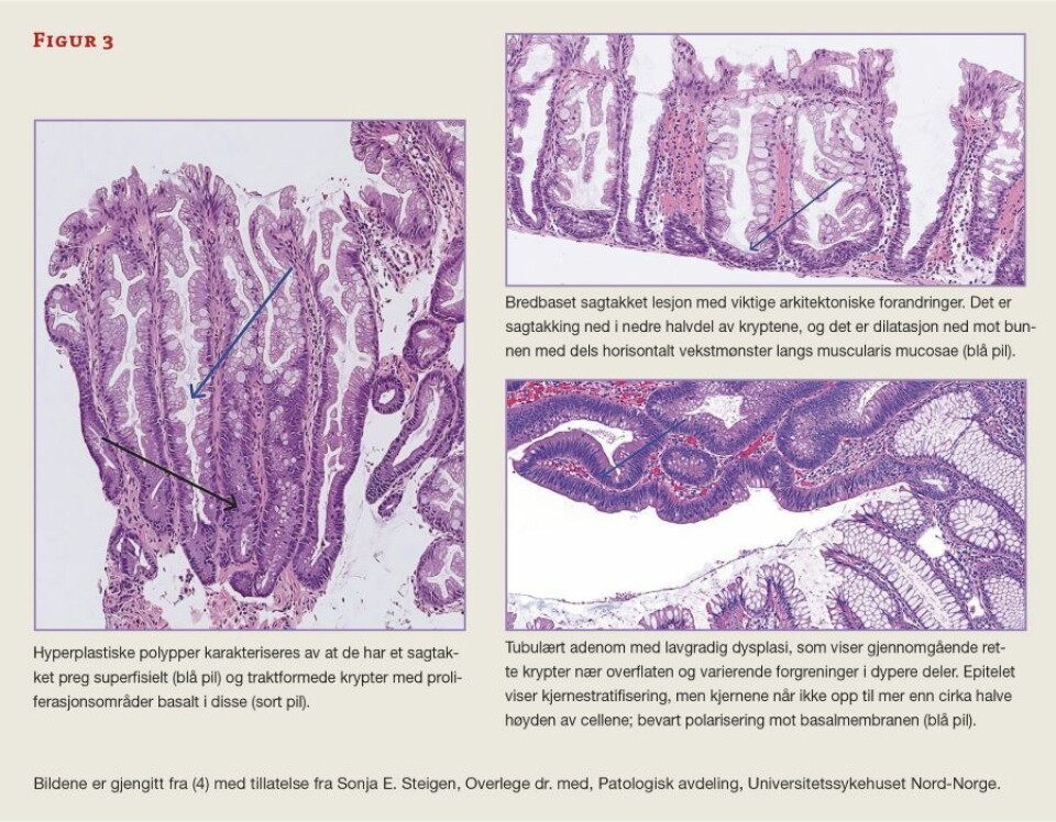 Fra cervixcytologi til tarmscreening