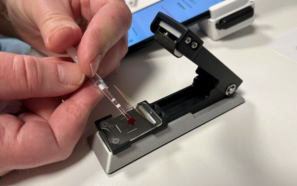 Vi må se på om noe av det som gjøres på laboratoriene i dag, i stedet kan utføres hjemme hos pasienten. Bildet viser utstyr for prøvetaking og analysering som brukes av pasienter i Hjemmelab-prosjektet til Sykehuset Østfold. Arkivfoto: Grete Hansen