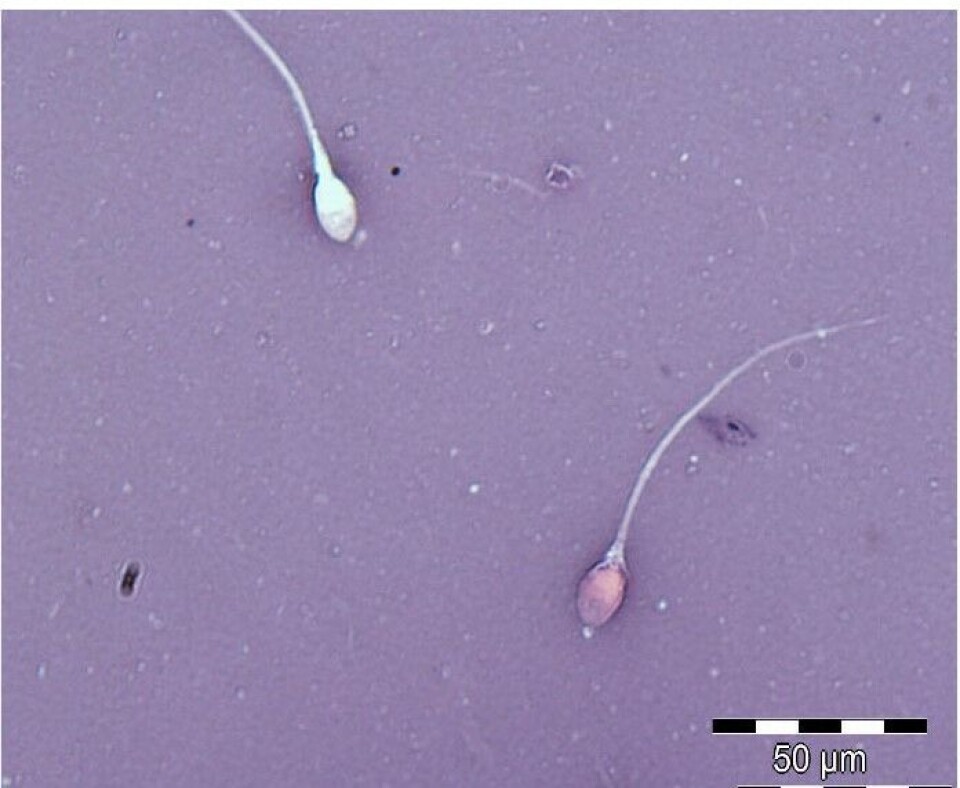 Figur 2: Spermievitalitet. Spermier farget med eosin-nigrosin fargeløsning. Rød spermie klassifiseres som død, hvit som levende. Foto: Forskningsgruppen 'Reproduktiv helse hos menn', HiOA