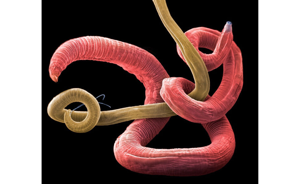 Dette bildet av rundormer er ett av fotografiene som skal stilles ut. Foto: Jannicke Wiik-Nielsen, Veterinærinstituttet.