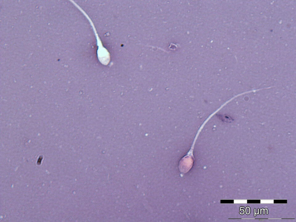 VITALITET: På laboratoriet på OsloMet undersøker man blant annet om sædcellene er døde eller levende. Bildet viser spermier farget med eosin-nigrosin fargeløsning. Rød spermie klassifiseres som død, hvit som levende. (Foto: Forskningsgruppen 'Reproduktiv helse hos menn', OsloMet)
