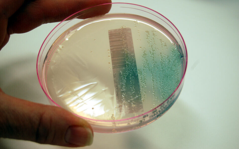 Slik ser det ut når Pseudomonas aeruginosa vokser på selektiv agarskål. Den grønne fargen kommer av at stoffer i skålen fører til en økning i bakteriens pigmentproduksjon.
