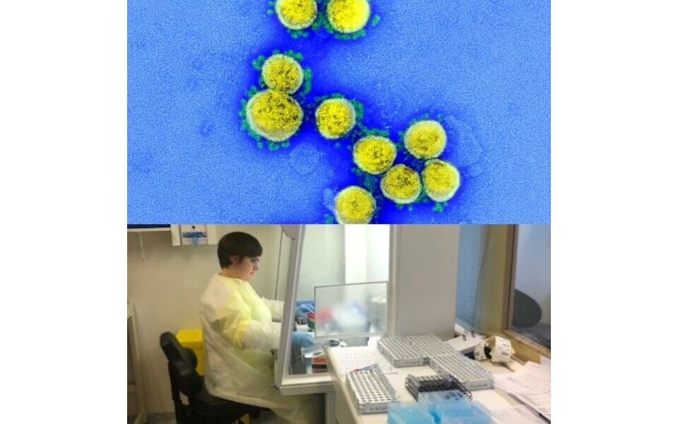 Rundt om på laboratorier i hele landet jobber bioingeniører nå intenst med koronaprøver. Ressurser flyttes fra andre oppgaver for å bidra i arbeidet med pandemiviruset SARS-CoV-2. Bildet (nederst) er fra Universitetssykehuset Nord-Norge. Foto: NIAID og Ellen Josefsen.