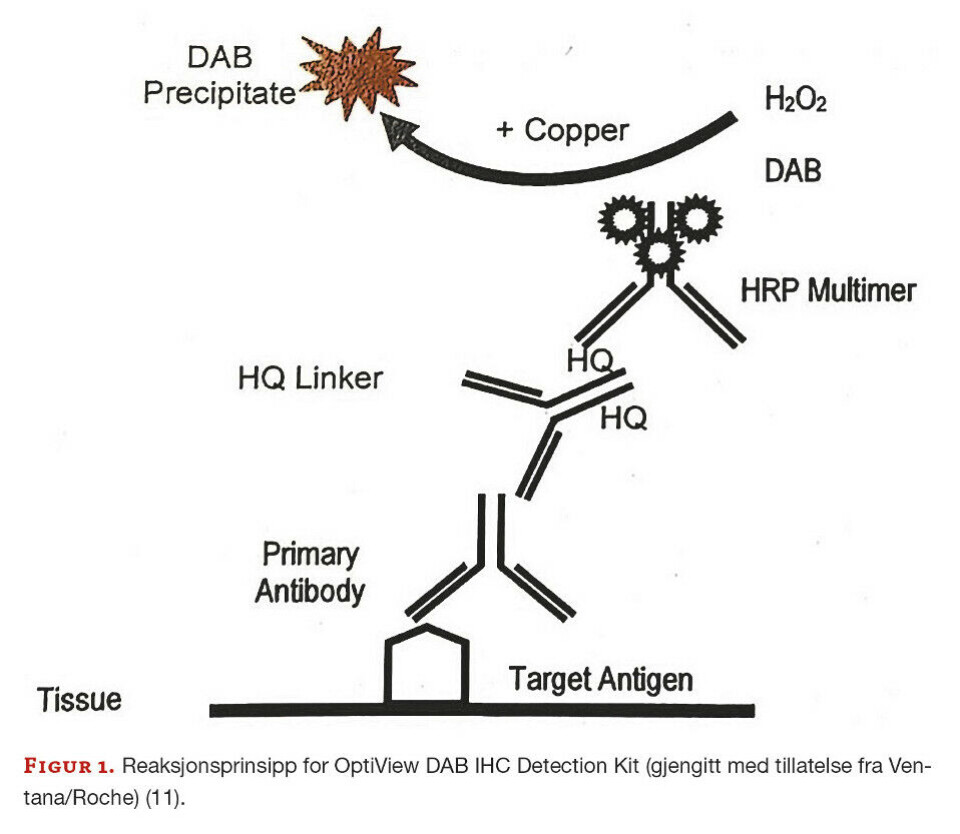 Immunhistokjemisk påvisning av mismatch repair-proteiner