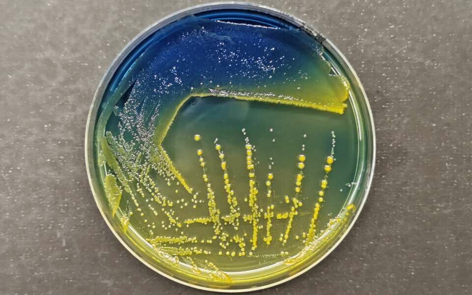 Klebsiella pneumoniae (store gullkolonier) dyrket fra en avføringsprøve på Klebsiella-spesifikt SCAI-medium. Illustrasjonsfoto: Kenneth Lindstedt