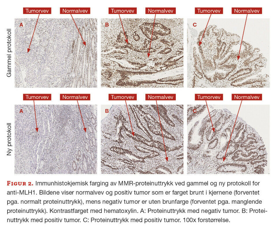 Immunhistokjemisk påvisning av mismatch repair-proteiner
