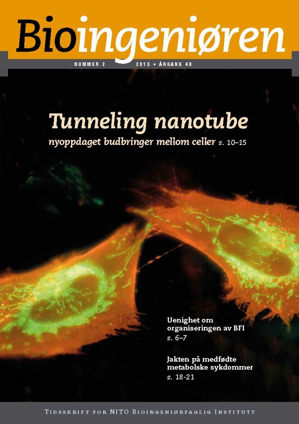 2/13: Vitenskap: Tunneling nanotube