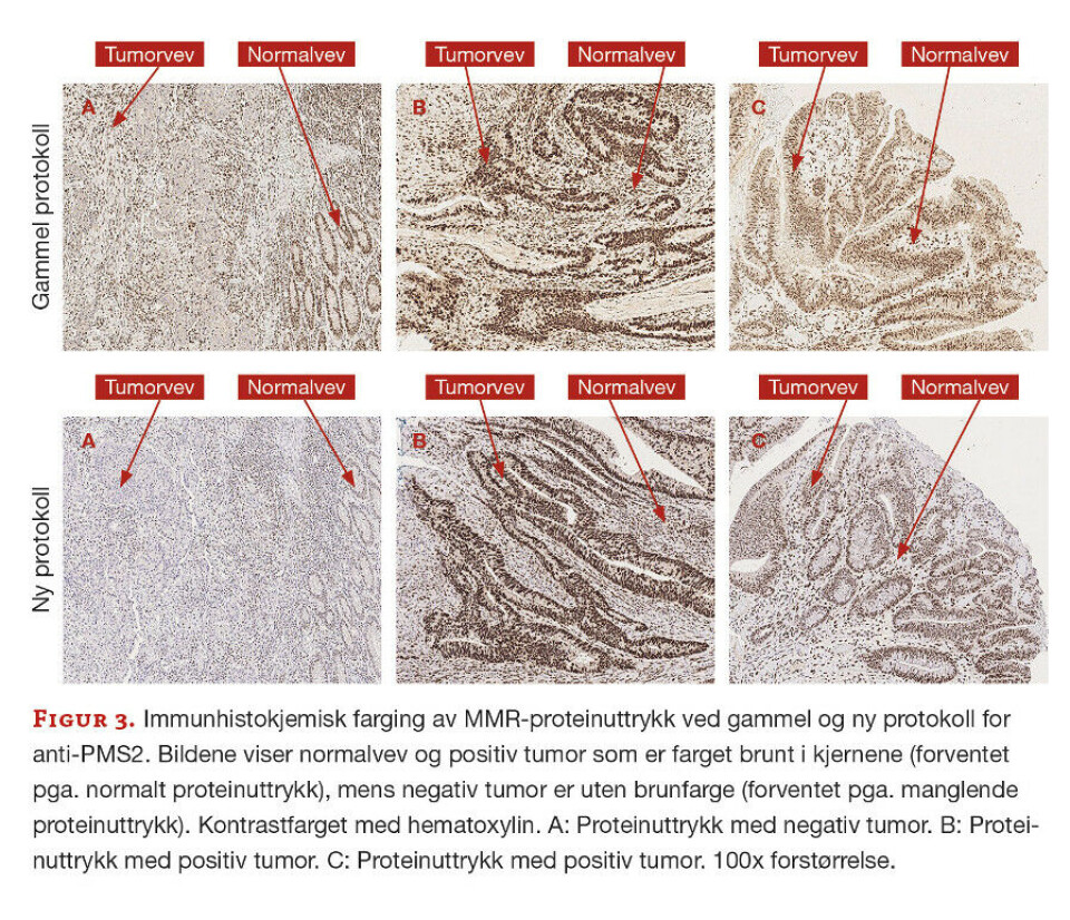 Immunhistokjemisk påvisning av mismatch repair-proteiner