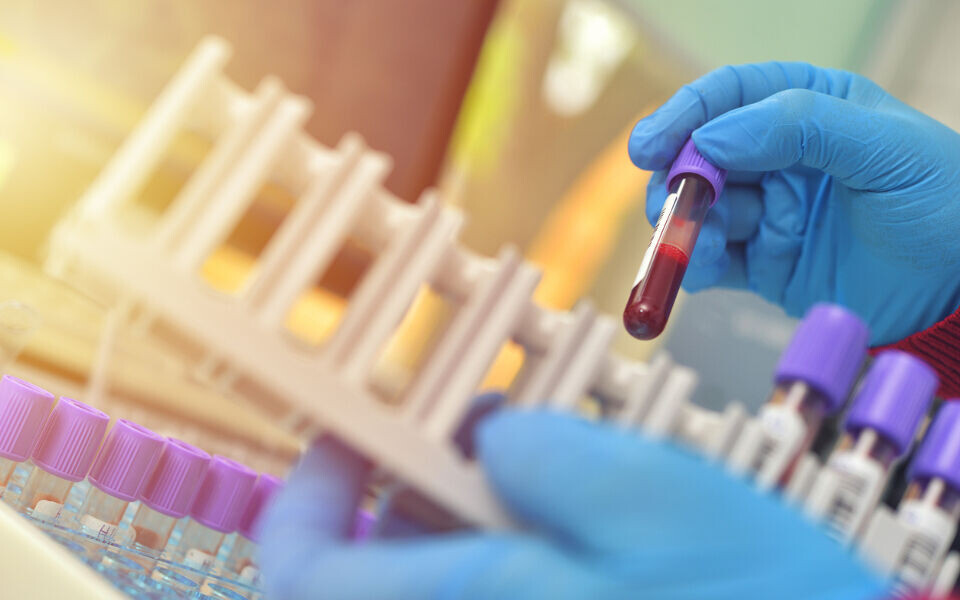 Hematologi er et populært spesialiseringsområde. 11 av de 63 bioingeniørene som er godkjent, har en spesialisering i hematologi. Foto: iStockphoto.