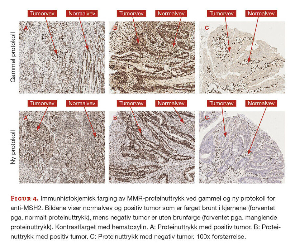 Immunhistokjemisk påvisning av mismatch repair-proteiner