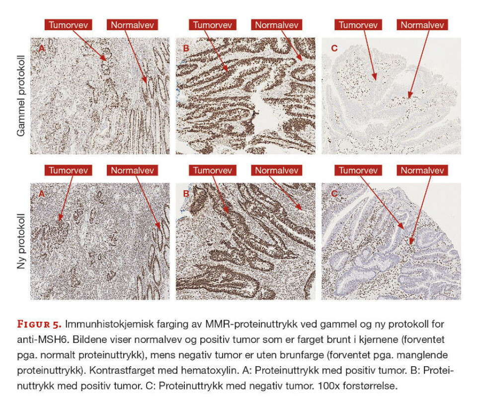 Immunhistokjemisk påvisning av mismatch repair-proteiner