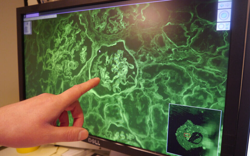 Digital patologi er allerede innført, eller på vei inn i, de fleste laboratoriene. Men digitaliseringen er bare en del av løsningen på utfordringene. Arkivfoto: Roald Marker