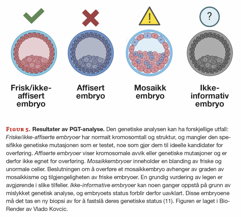 Preimplantasjonsgenetisk testing: Figur 5. Resultater av PGT-analyse. Den genetiske analysen kan ha forskjellige utfall: Friske/ikke-affiserte embryoer har normalt kromosomtall og struktur, og mangler den spesifikke genetiske mutasjonen som er testet, noe som gjør dem til ideelle kandidater for overføring. Affiserte embryoer viser kromosomale avvik eller genetiske mutasjoner og er derfor ikke egnet for overføring. Mosaikkembryoer inneholder en blanding av friske og unormale celler. Beslutningen om å overføre et mosaikkembryo avhenger av graden av mosaikkisme og tilgjengeligheten av friske embryoer. En grundig vurdering av legen er avgjørende i slike tilfeller. Ikke-informative embryoer kan noen ganger oppstå på grunn av mislykket genetisk analyse, og embryoets status forblir derfor uavklart. Disse embryoene må det tas en ny biopsi av for å fastslå deres genetiske status (11). Figuren er laget i BioRender av Vlado Kovcic.