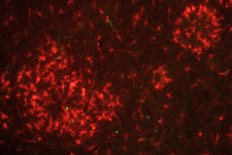 Da vi jobbet med hjerneceller fra mus’ hippocampus, stresset vi dem og gjorde cellene syke, før vi behandlet dem med trent eller utrent plasma. Mikroskopbildet viser aktivert mikroglia i hjernen til en 12 måneder gammel Alzheimer-rotte. Vi ser immunfarging for Iba1 (rød) og CD68 (grønn), markører for henholdsvis mikroglia og deres fagocyterende aktivitet. Mikroglia ser ut til å hope seg opp rundt amyloide plakk – kanskje i forsøk på å rydde opp? Vi har undersøkt om ExPlas kan gjøre denne ryddejobben mer effektiv. Mikroskopbilde