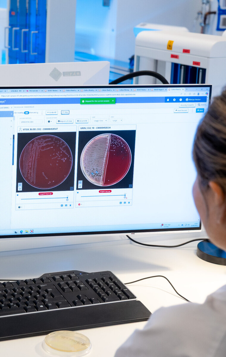 ØKT PASIENTSIKKERHET: Automatisk prøvebehandling reduserer risikoen for feil og variasjon. Målet er økt pasientsikkerhet.
De ansatte på laboratoriet vil fremover bruke langt mindre tid på tidkrevende oppgaver som utsæd og flytting av skåler inn og ut av inkubator. Dette skjer nå automatisk. Det betyr at bioingeniørene får bedre tid til det som krever mest kompetanse: avlesning og viderearbeid.
I tillegg gir systemet full sporbarhet og digital bildedokumentasjon av skålene. Håpet er at det vil forenkle kommunikasjon og faglige diskusjoner mellom bioingeniører og mikrobiologer.